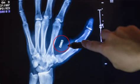 how to destroy rfid chip in body|How would one damage or deactivate an implanted microchip .